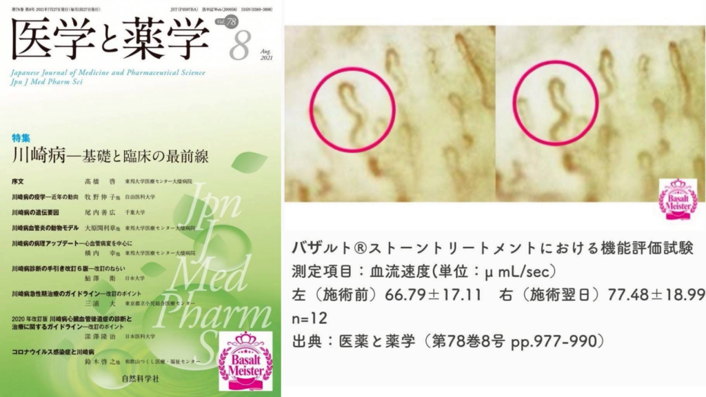 アロマドライヘッドスパサロンRomiere（ロミエル）船橋店への道順のバザルトストーンのエビデンス